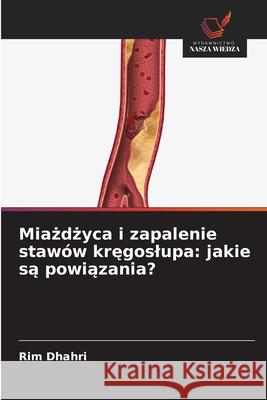 Miazdzyca i zapalenie stawów kregoslupa: jakie sa powiazania? Dhahri, Rim 9786209286506 Wydawnictwo Nasza Wiedza - książka