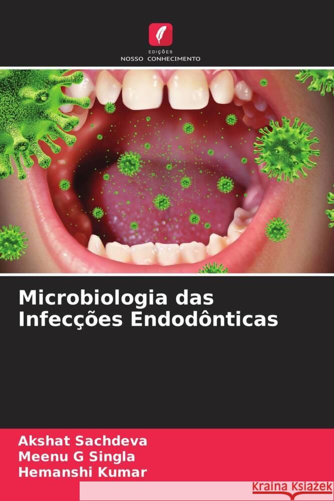 Microbiologia das Infecções Endodônticas Sachdeva, Akshat, Singla, Meenu G, Kumar, Hemanshi 9786204772424 Edições Nosso Conhecimento - książka