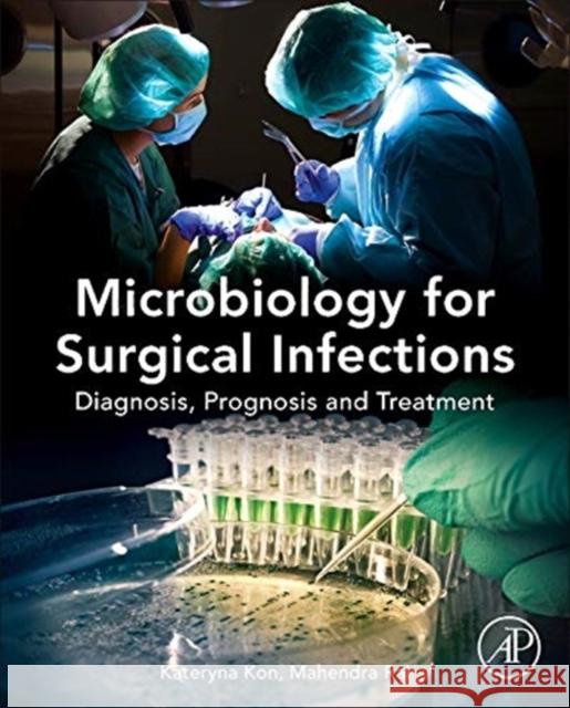 Microbiology for Surgical Infections: Diagnosis, Prognosis and Treatment Kon, Kateryna 9780124116290 ACADEMIC PRESS - książka