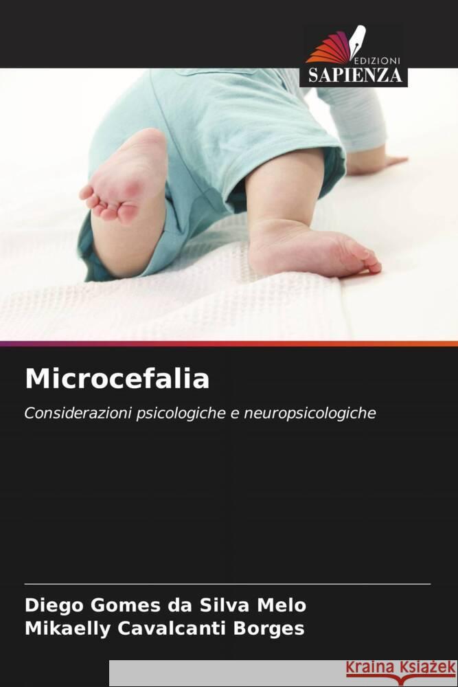 Microcefalia Gomes da Silva Melo, Diego, Borges, Mikaelly Cavalcanti 9786206460848 Edizioni Sapienza - książka