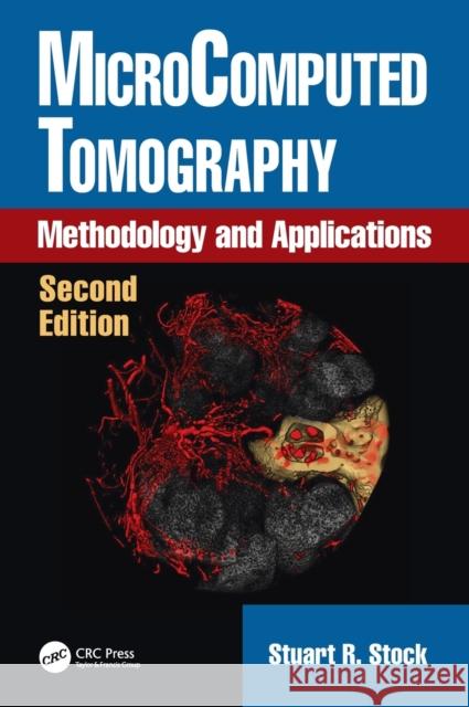 Microcomputed Tomography: Methodology and Applications, Second Edition Stuart R. Stock 9781498774970 CRC Press - książka