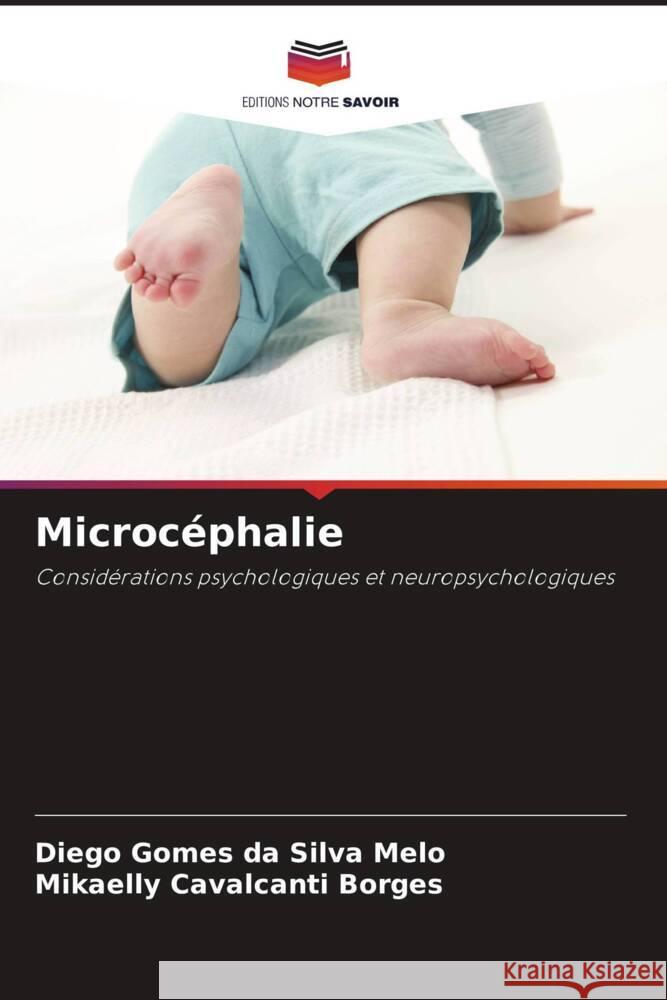 Microcéphalie Gomes da Silva Melo, Diego, Borges, Mikaelly Cavalcanti 9786206460831 Editions Notre Savoir - książka
