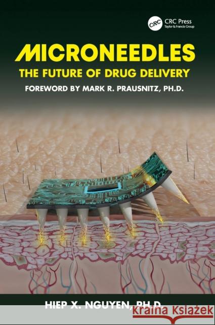 Microneedles: The Future of Drug Delivery Hiep Xuan Nguyen 9780367266509 CRC Press - książka