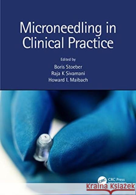 Microneedling in Clinical Practice Boris Stoeber Raja K. Sivamani Howard I. Maibach 9781138035690 CRC Press - książka