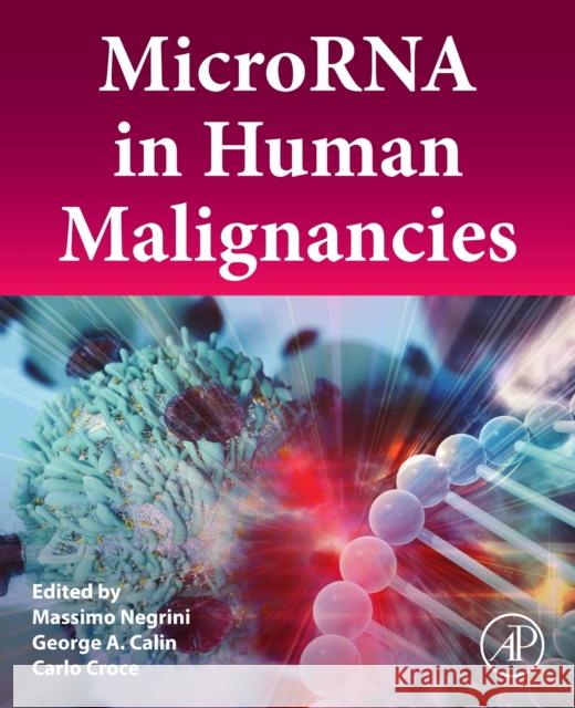 Microrna in Human Malignancies Massimo Negrini George A. Calin Carlo Croce 9780128222874 Academic Press - książka