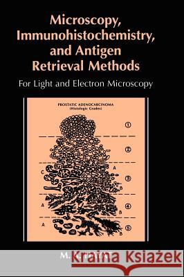 Microscopy, Immunohistochemistry, and Antigen Retrieval Methods: For Light and Electron Microscopy Hayat, M. A. 9780306467707 Kluwer Academic Publishers - książka