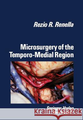 Microsurgery of the Temporo-Medial Region Rezio R. Renella 9783709190548 Springer - książka