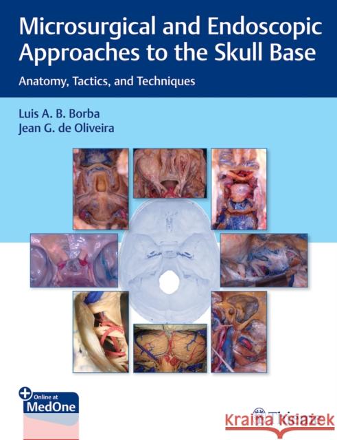 Microsurgical and Endoscopic Approaches to the Skull Base: Anatomy, Tactics, and Techniques Luis Borba Jean d 9781626239661 Thieme Medical Publishers - książka