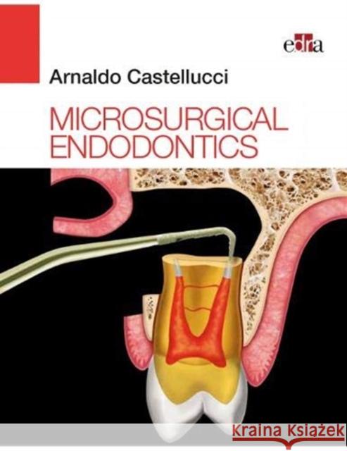 Microsurgical Endodontics Elio Berruti 9788821448188 CBL DISTRIBUTION LIMITED - książka