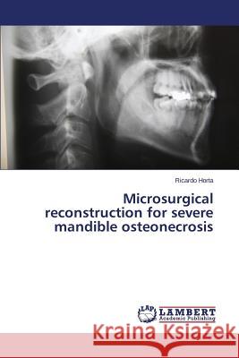 Microsurgical reconstruction for severe mandible osteonecrosis Horta Ricardo 9783659609497 LAP Lambert Academic Publishing - książka