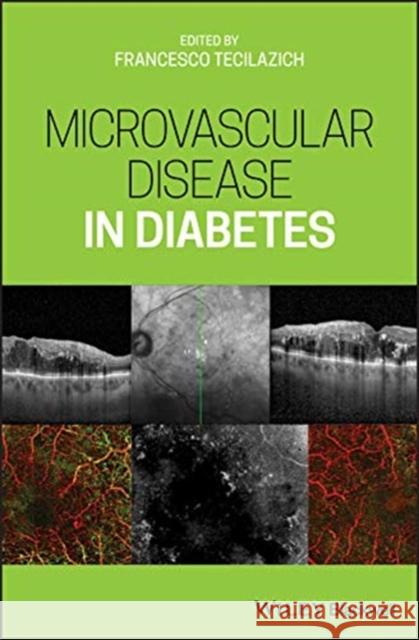 Microvascular Disease in Diabetes Francesco Tecilazich 9781119309604 Wiley-Blackwell - książka