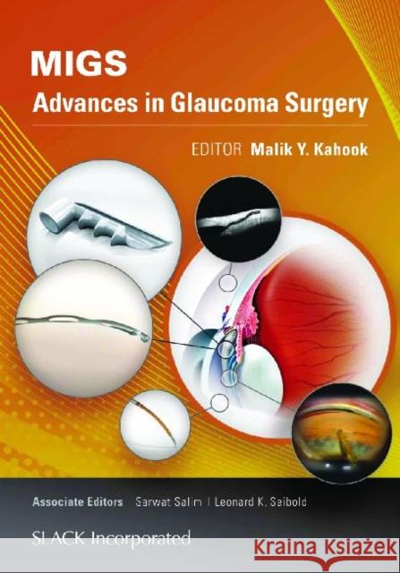Migs: Advances in Glaucoma Surgery Kahook, Malik 9781617116001 Slack - książka
