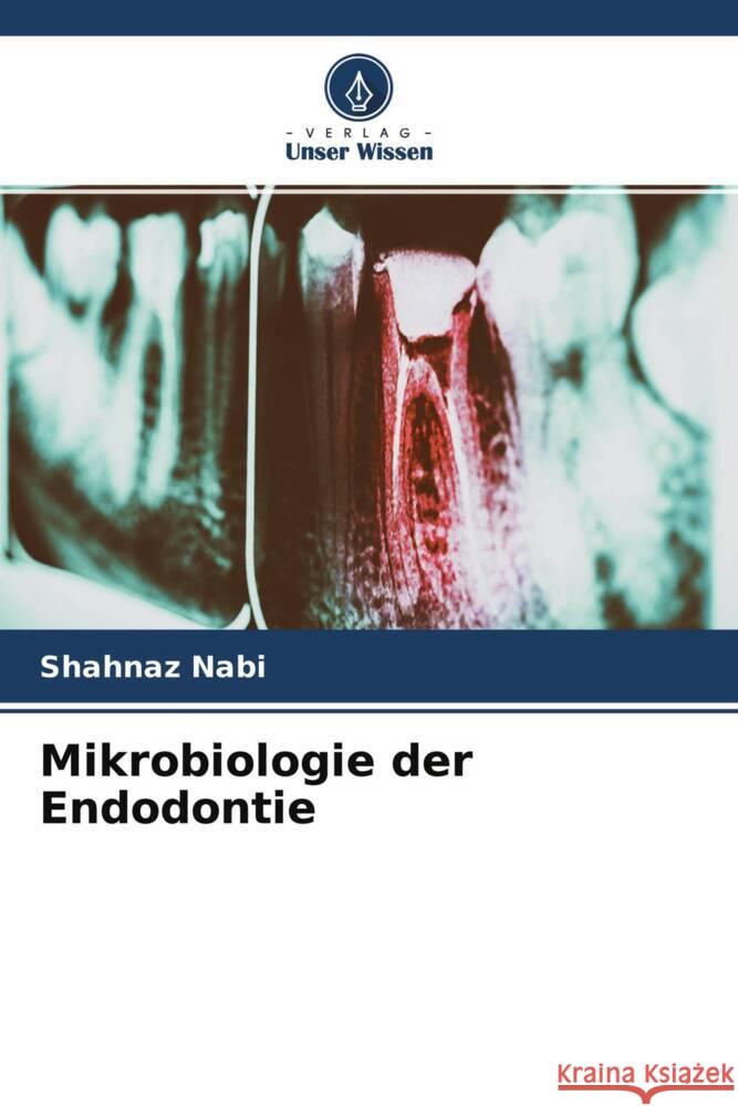 Mikrobiologie der Endodontie Nabi, Shahnaz 9786204339832 Verlag Unser Wissen - książka