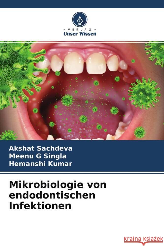 Mikrobiologie von endodontischen Infektionen Sachdeva, Akshat, Singla, Meenu G, Kumar, Hemanshi 9786204772387 Verlag Unser Wissen - książka