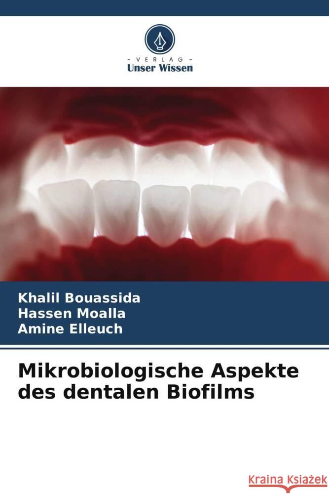 Mikrobiologische Aspekte des dentalen Biofilms Bouassida, Khalil, Moalla, Hassen, Elleuch, Amine 9786206642145 Verlag Unser Wissen - książka