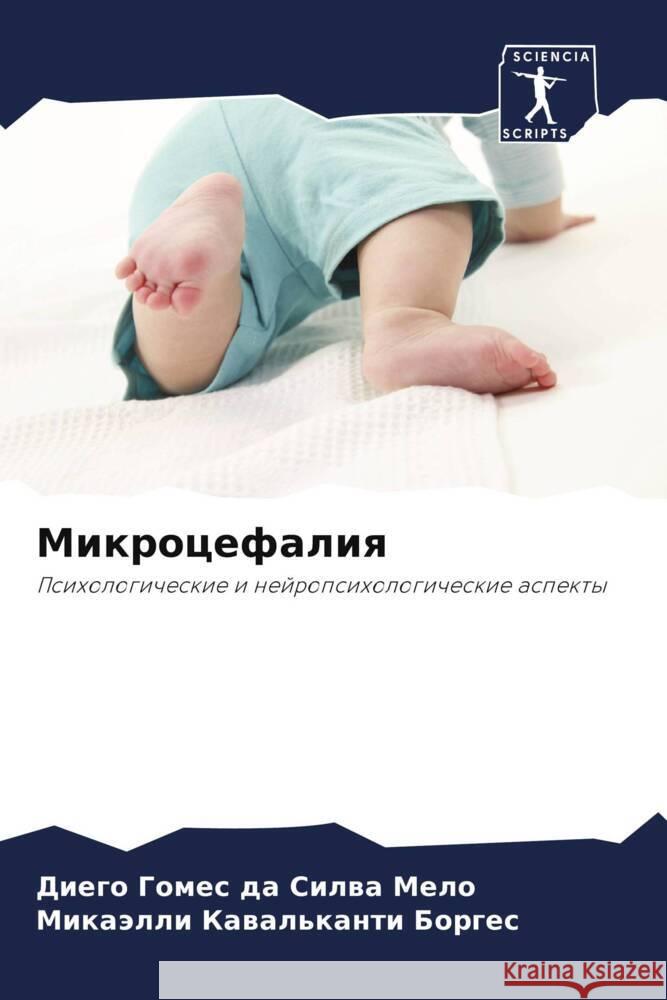 Mikrocefaliq Gomes da Silwa Melo, Diego, Borges, Mikaälli Kawal'kanti 9786206460824 Sciencia Scripts - książka