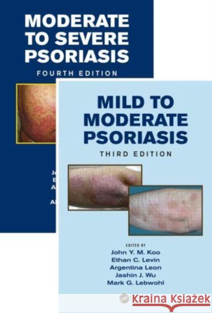 Mild to Moderate and Moderate to Severe Psoriasis (Set) John Y. M. Koo Ethan C. Levin Argentina Leon 9781482215021 Taylor and Francis - książka