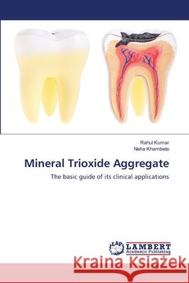 Mineral Trioxide Aggregate Rahul Kumar Neha Khambete 9783659110153 LAP Lambert Academic Publishing - książka