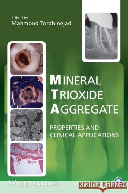 Mineral Trioxide Aggregate: Properties and Clinical Applications Torabinejad, Mahmoud 9781118401286 John Wiley & Sons - książka