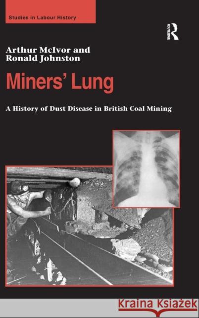 Miners' Lung: A History of Dust Disease in British Coal Mining McIvor, Arthur 9780754636731 Ashgate Publishing Limited - książka