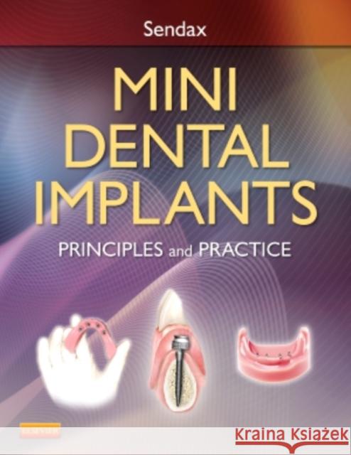Mini Dental Implants: Principles and Practice Sendax, Victor Dr 9781455743865 MOSBY - książka