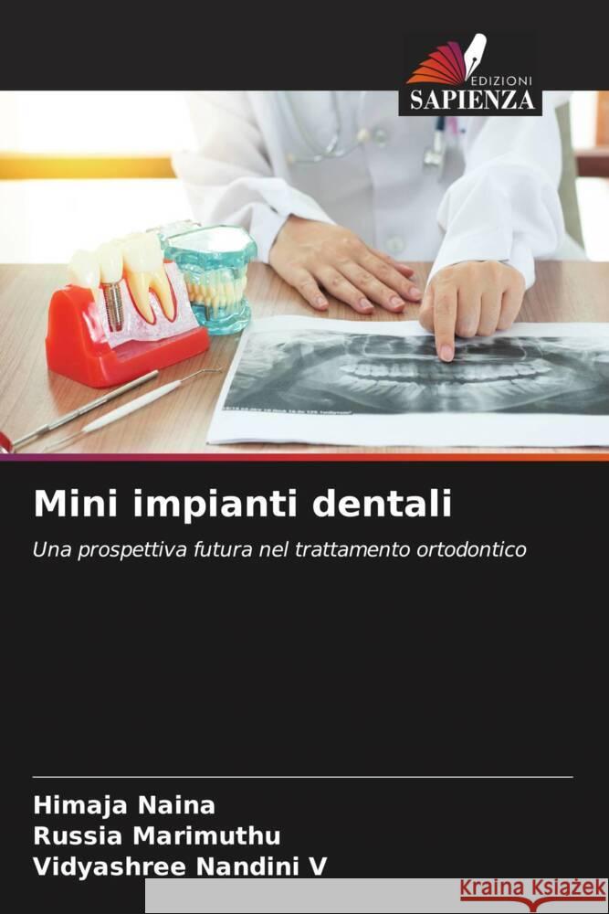 Mini impianti dentali Himaja Naina Russia Marimuthu Vidyashree Nandin 9786206859277 Edizioni Sapienza - książka