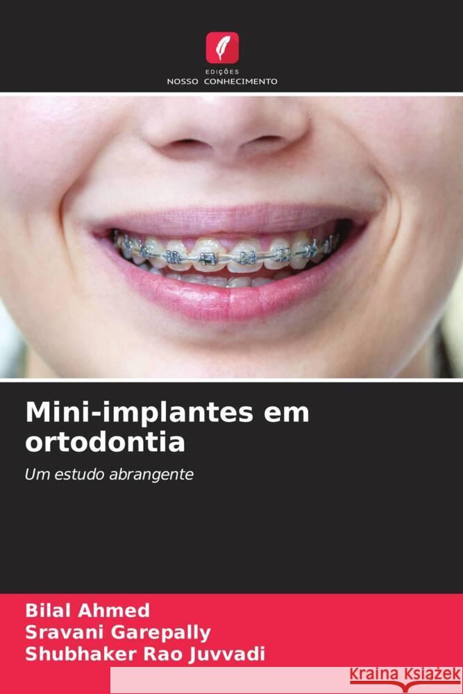 Mini-implantes em ortodontia Bilal Ahmed Sravani Garepally Shubhaker Rao Juvvadi 9786206057079 Edicoes Nosso Conhecimento - książka