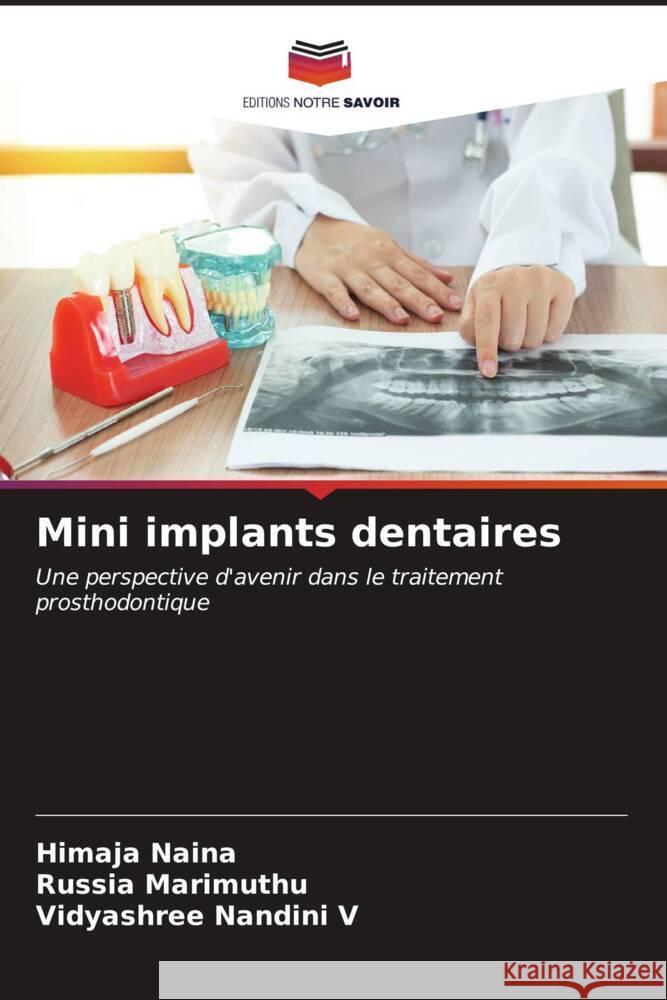 Mini implants dentaires Naina, Himaja, Marimuthu, Russia, Nandini V, Vidyashree 9786206859239 Editions Notre Savoir - książka