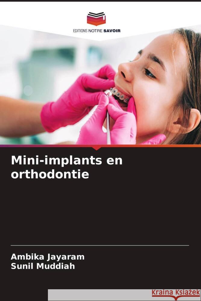 Mini-implants en orthodontie Ambika Jayaram Sunil Muddiah 9786207053247 Editions Notre Savoir - książka