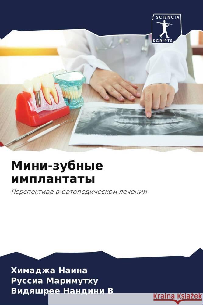 Mini-zubnye implantaty Naina, Himadzha, Marimuthu, Russia, Nandini V, Vidqshree 9786206859260 Sciencia Scripts - książka