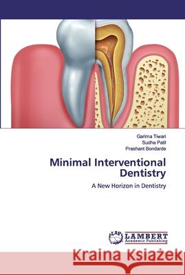 Minimal Interventional Dentistry Tiwari, Garima 9786200431363 LAP Lambert Academic Publishing - książka