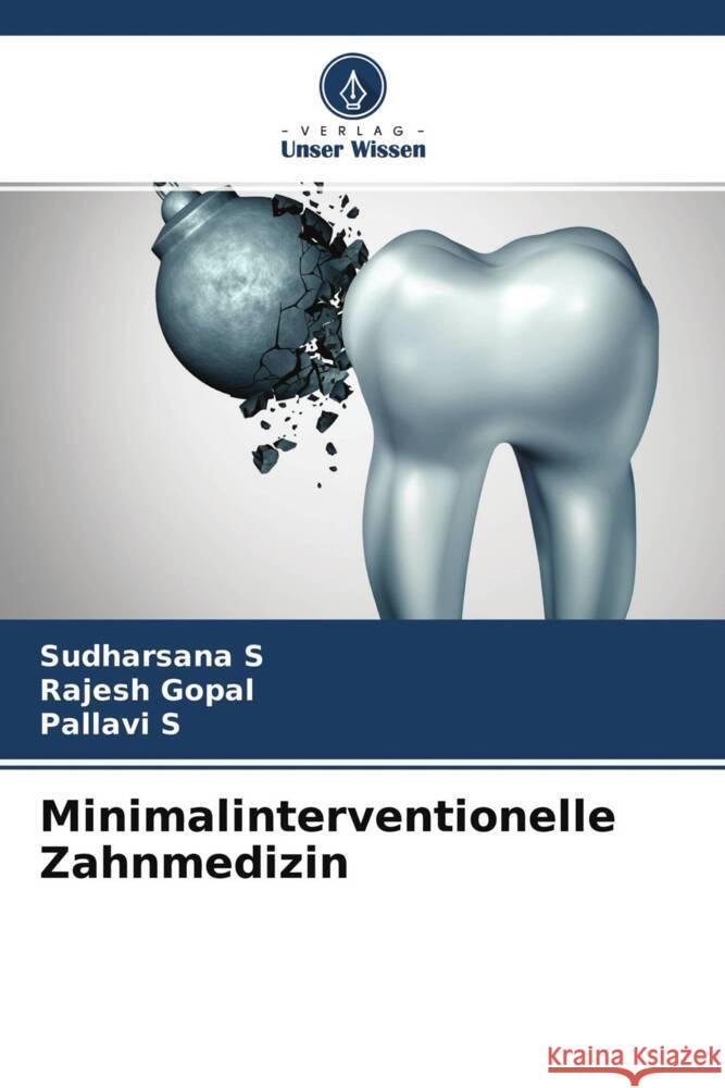 Minimalinterventionelle Zahnmedizin S, Sudharsana, Gopal, Rajesh, S, Pallavi 9786204411088 Verlag Unser Wissen - książka