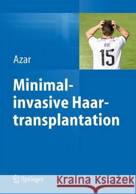 Minimalinvasive Haartransplantation Reza P. Azar 9783642545597 Springer - książka