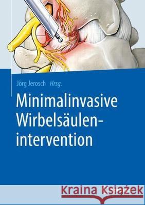 Minimalinvasive Wirbelsäulenintervention  9783662580936 Springer - książka