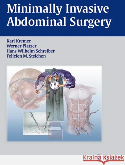 Minimally Invasive Abdominal Surgery: Laparascopic and Thoracic Surgery Kremer, Karl 9783131081919 Thieme Publishing Group - książka