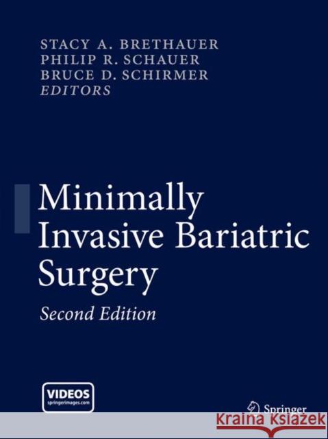 Minimally Invasive Bariatric Surgery  9781493916368 Not Avail - książka