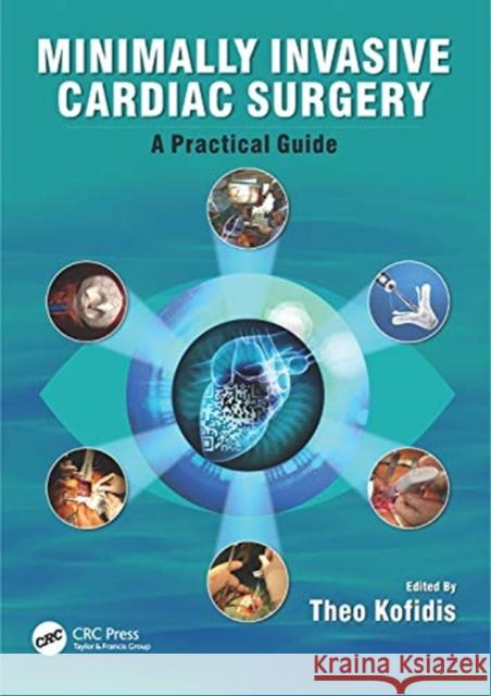 Minimally Invasive Cardiac Surgery: A Practical Guide Kofidis, Theo 9781498736466 CRC Press - książka