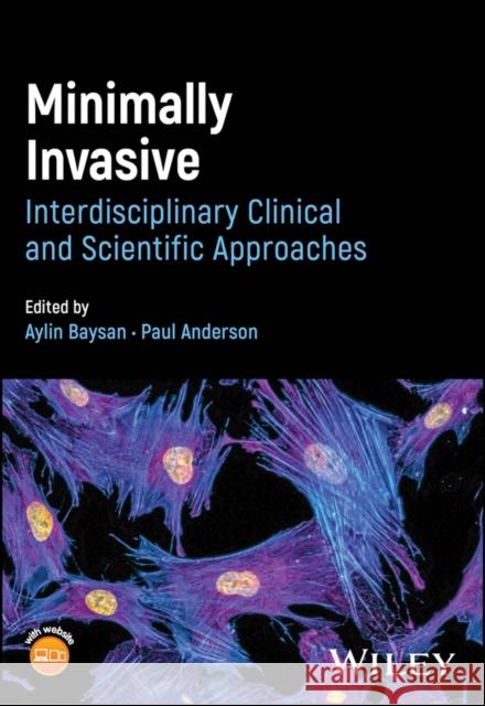 Minimally Invasive Dentistry Paul (Queen Mary University of London, UK) Anderson 9781119215066 John Wiley and Sons Ltd - książka