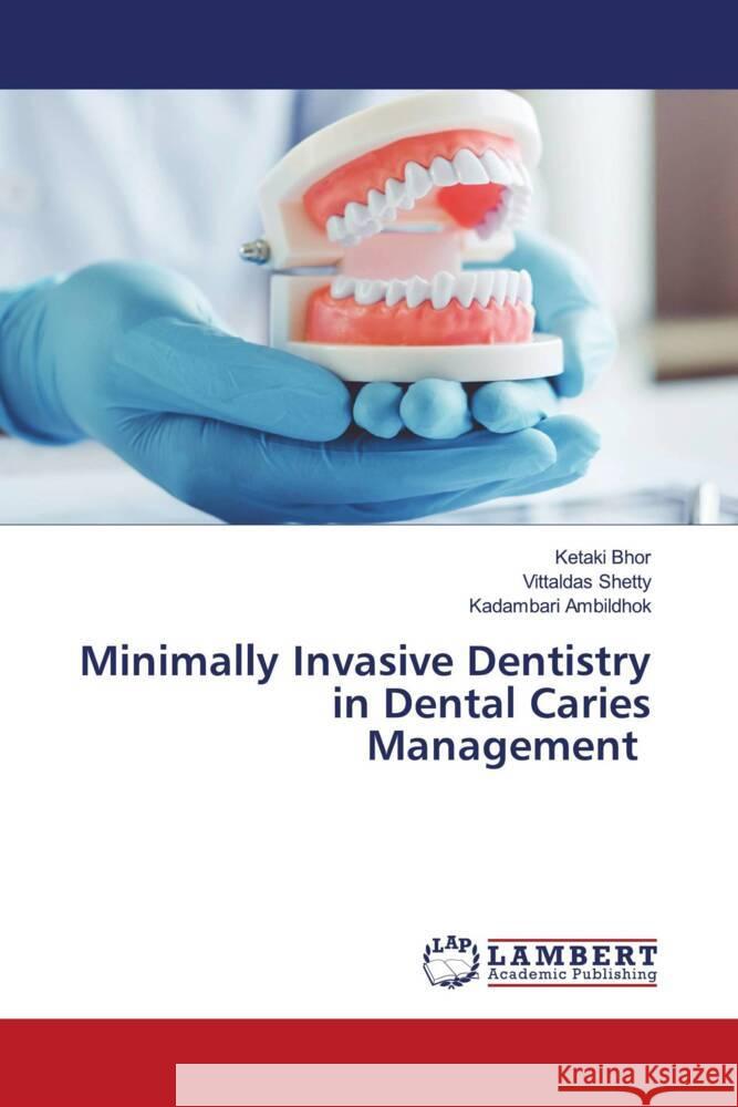 Minimally Invasive Dentistry in Dental Caries Management Bhor, Ketaki, Shetty, Vittaldas, Ambildhok, Kadambari 9786203855753 LAP Lambert Academic Publishing - książka