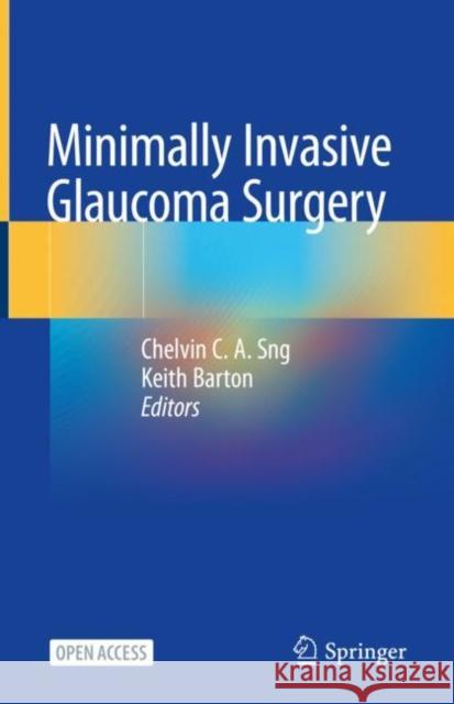 Minimally Invasive Glaucoma Surgery  9789811556319 Springer - książka