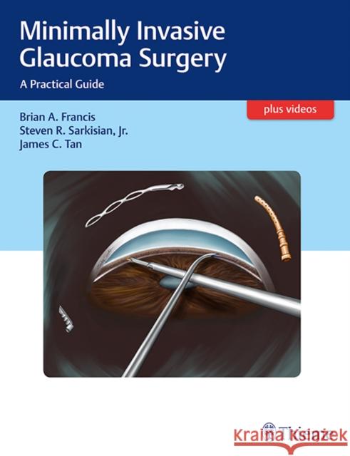 Minimally Invasive Glaucoma Surgery: A Practical Guide Francis, Brian 9781626231566 Thieme Medical Publishers - książka