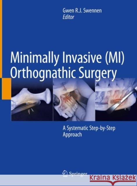 Minimally Invasive (MI) Orthognathic Surgery  9783031380112 Springer International Publishing AG - książka