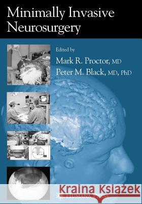 Minimally Invasive Neurosurgery Mark R. Proctor 9781617373879 Springer - książka