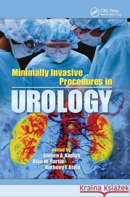 Minimally Invasive Procedures in Urology Steven A. Kaplan Alan W. Partin Anthony J. Atala 9780367393038 CRC Press - książka