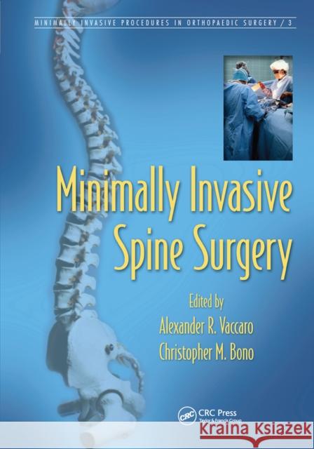 Minimally Invasive Spine Surgery Alexander R. Vaccaro Christopher M. Bono 9780367453060 CRC Press - książka