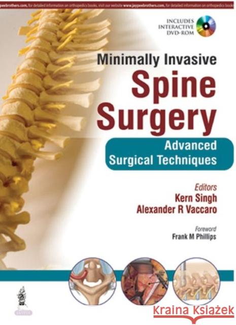 Minimally Invasive Spine Surgery Singh, Kern|||Vaccaro, Alexander R. 9789351524939  - książka