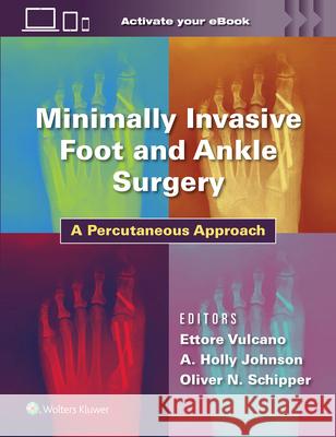 Minimally Invasive Surgery in Foot and Ankle: A Percutaneous Approach Ettore Vulcano Holly Johnson Oliver Schipper 9781975198701 LWW - książka