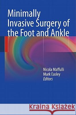 Minimally Invasive Surgery of the Foot and Ankle Mark Easley Nicola Maffulli 9781849964166 Springer - książka