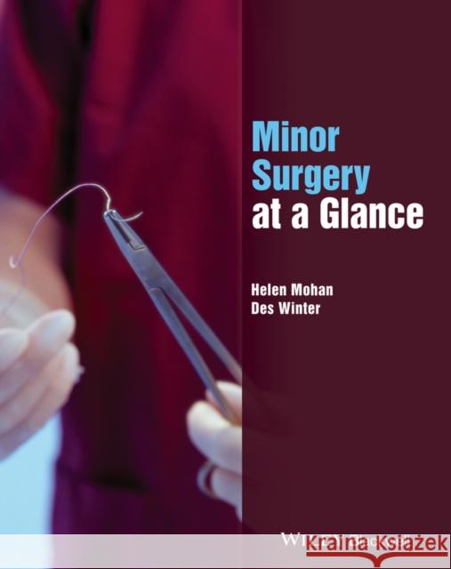 Minor Surgery at a Glance Helen Mohan Desmond Winter 9781118561447 Wiley-Blackwell - książka