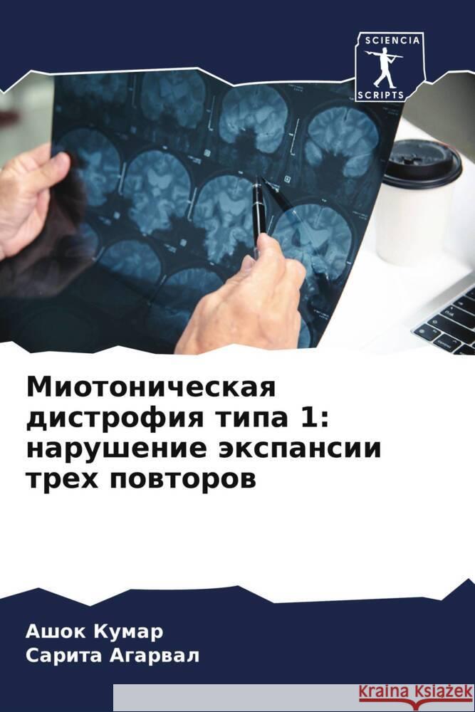 Miotonicheskaq distrofiq tipa 1: narushenie äxpansii treh powtorow Kumar, Ashok, Agarwal, Sarita 9786208160258 Sciencia Scripts - książka